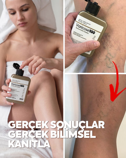 Varicose 100 - Almanya'dan İthal